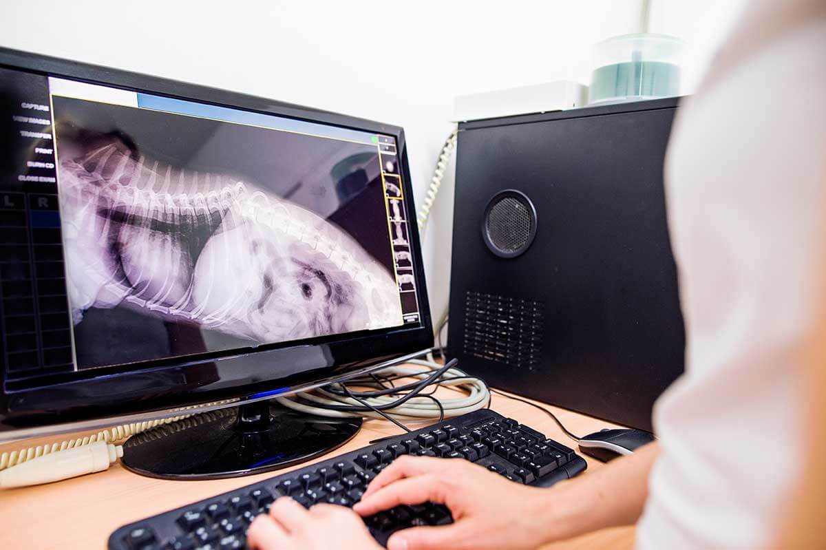 A digital x-ray